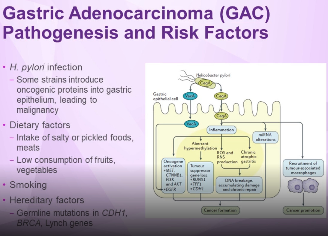 Pathogenesis & Risk Factors of Gastric Adenocarcinoma