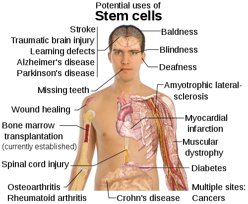 Stem cell treatments